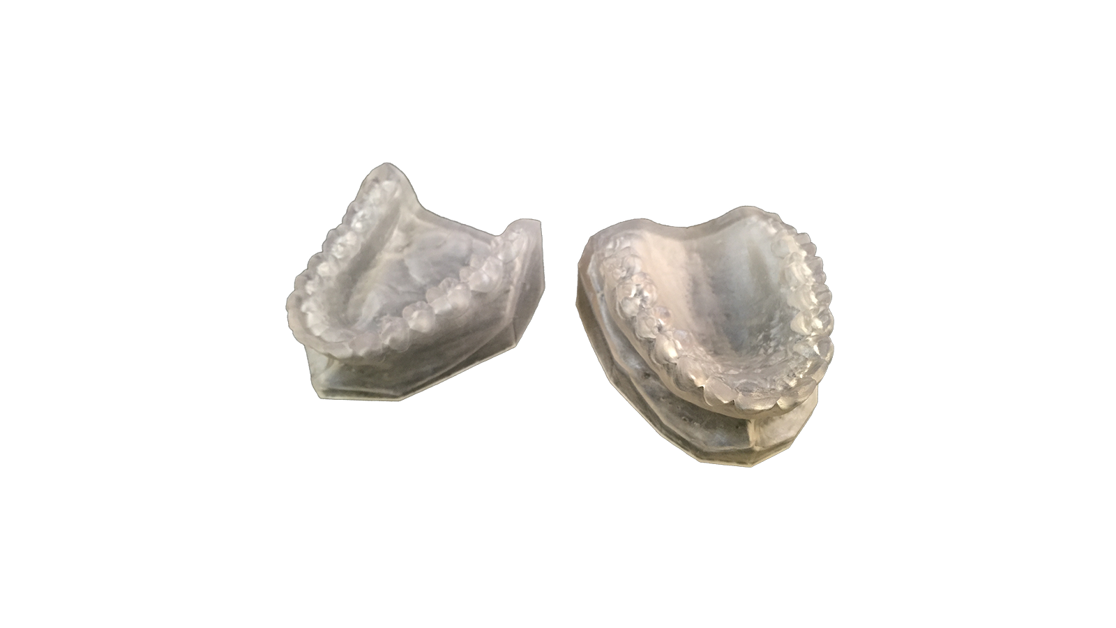 Modelli dentali stampa in resina 3D